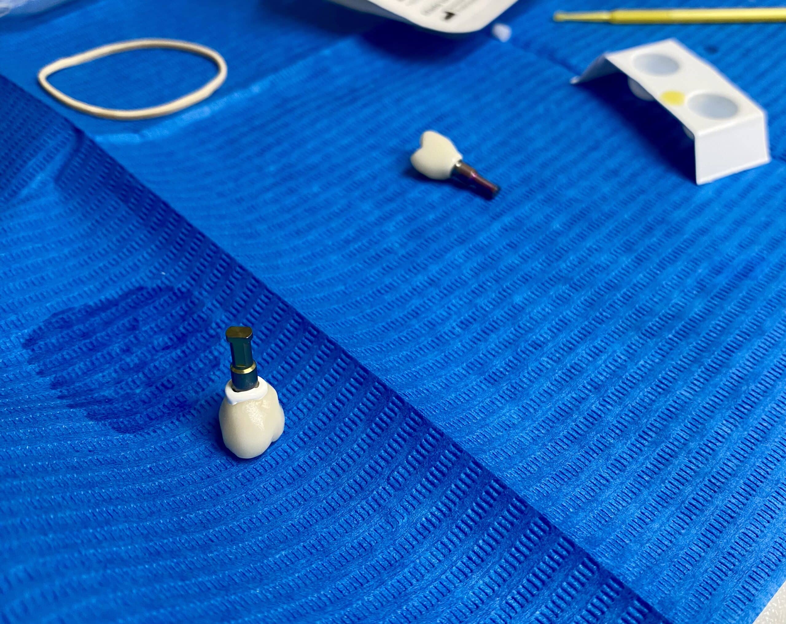 Tannimplantat i Sandefjord