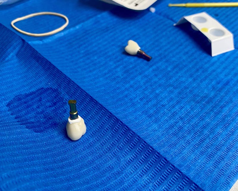 Tannlege Sandefjord implantater implantat sandefjord